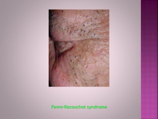 Ultraviolet Radiation (UVR) | PPTX