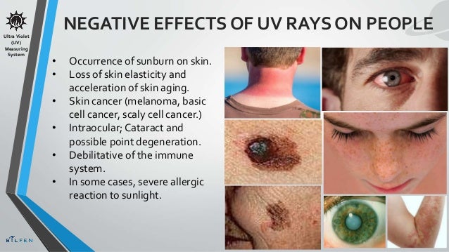 Are Uv Rays Harmful _ How UV Rays Affect Your Commercial Roof & How To ...