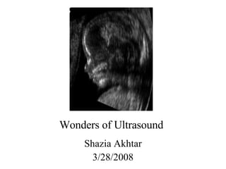 Wonders of Ultrasound   Shazia Akhtar 3/28/2008 