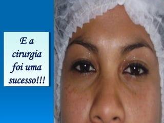 E a cirurgia foi uma sucesso!!! 