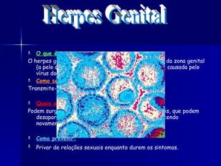 O que é: O herpes genital é uma doença de transmissão sexual da zona genital (a pele que rodeia o recto ou as áreas adjacentes), causada pelo vírus do herpes simples.  Como se transmite: Transmite-se só pelo contacto sexual. Quais os sintomas: Podem surgir umas pequenas bolhas nos órgãos genitais, que podem desaparecer ao fim de uma a duas semanas, aparecendo novamente.  Como prevenir: Privar de relações sexuais enquanto durem os sintomas.   Herpes Genital 