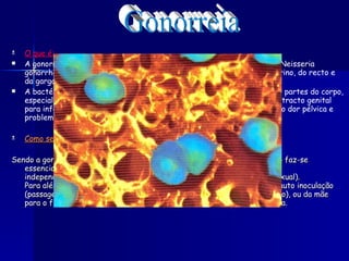 O que é: A gonorreia é uma doença de transmissão sexual causada pela bactéria Neisseria gonorrhoeae, que infecta o revestimento mucoso da uretra, do colo uterino, do recto e da garganta ou da membrana branca (conjuntiva) dos olhos.  A bactéria pode propagar-se através da corrente sanguínea para outras partes do corpo, especialmente a pele e as extremidades. Nas mulheres, pode subir pelo tracto genital para infectar as membranas que se encontram dentro da bacia, causando dor pélvica e problemas reprodutivos. Como se transmite: Sendo a gonorreia uma doença sexualmente transmissível a sua transmissão faz-se essencialmente através do contacto sexual com um indivíduo infectado, independentemente da natureza do relacionamento (hetero ou homossexual). Para além do contágio por via sexual a infecção pode transmitir-se por auto inoculação (passagem da infecção de um local para outro do corpo feita pelo próprio), ou da mãe para o filho no momento do parto se a grávida está afectada pela doença.  Gonorreia 
