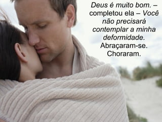 Deus é muito bom. –  completou ela –  Você não precisará contemplar a minha deformidade. Abraçaram-se. Choraram. 