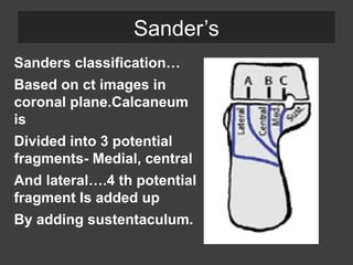 Sanders Classification Examples Umar Sultan hshahahhwuiiwbbbhhaiujah.pptx