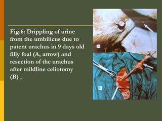 Fig.6: Drippling of urine
from the umbilicus due to
patent urachus in 9 days old
filly foal (A, arrow) and
resection of the urachus
after mildline celiotomy
(B) .

 