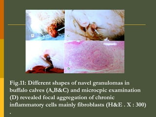 Fig.11: Different shapes of navel granulomas in
buffalo calves (A,B&C) and microcpic examination
(D) revealed focal aggregation of chronic
inflammatory cells mainly fibroblasts (H&E . X : 300)
.

 