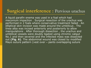 Surgical interference : Pervious urachus
A liquid parafin enema was used in a foal which had
meconium impaction . Surgical resection of the urachus was
performed in 2 foals where conservative treatment failed . An
elliptical skin incision was made around the umbilicus . The
linea alba was incised anteriorly and posteriorly to allow
manipulations . After thorough dissection , the urachus and
umbilical vessels were doubly ligated using chromic catgut
No.1 and then severed and the infected mass was dissected
out (Fig. 6). The abdominal wound was closed by modified
Mayo suture pattern (vest over – pants overlapping suture

 