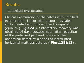 Results
Umbilical eventeration
Clinical examination of the calves with umbilical
eventeration 1 hour after labour , revealed
contaminated and fully exposed congested
jejunum ( Fig.12A ). Satisfactory recovery was
obtained 14 days postoperation after reduction
of the prolapsed part and closure of the
abdominal defect by a series of interrupted
horizontal mattress sutures ( Figs.12B&13) .

 