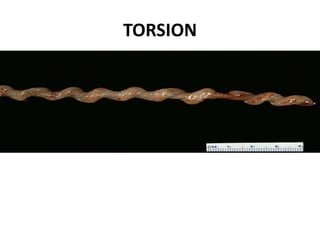 TORSION
 