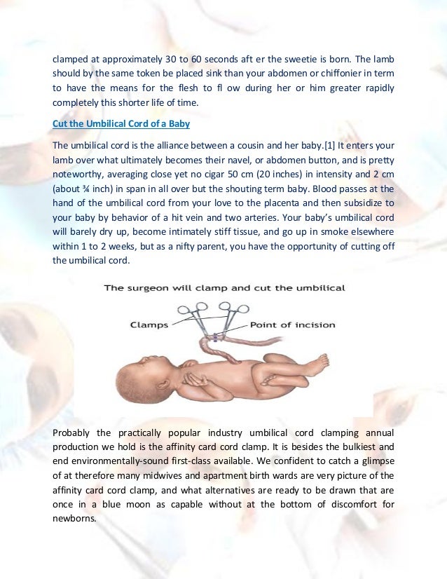 Umbilical Cord Clamping After Birth
