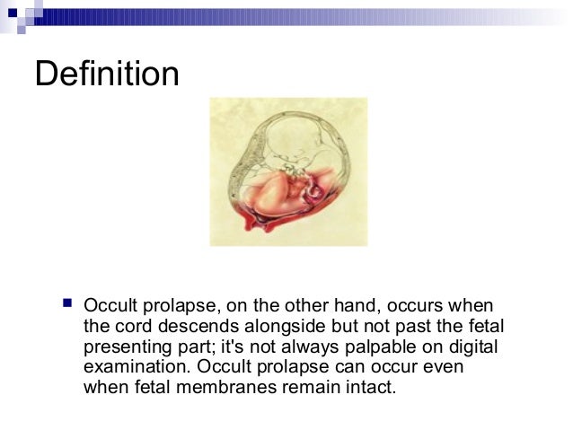 umbilical cord prolapse prolapsed cord