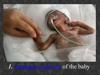 Umbilical Cord Prolapse, Presented By Mohammed Haroon Rashid