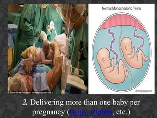 Umbilical Cord Prolapse, Presented By Mohammed Haroon Rashid