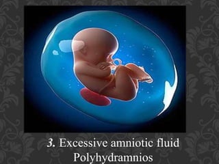 Umbilical Cord Prolapse, Presented By Mohammed Haroon Rashid