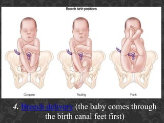 Umbilical Cord Prolapse, Presented By Mohammed Haroon Rashid