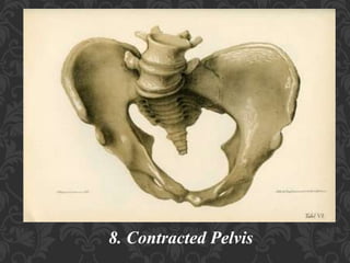 Umbilical Cord Prolapse, Presented By Mohammed Haroon Rashid