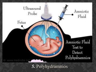 Umbilical Cord Prolapse, Presented By Mohammed Haroon Rashid