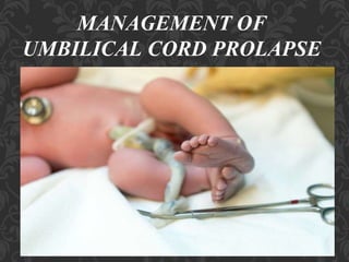 Umbilical Cord Prolapse, Presented By Mohammed Haroon Rashid
