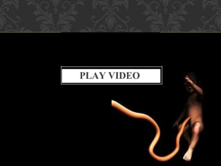 Umbilical Cord Prolapse, Presented By Mohammed Haroon Rashid