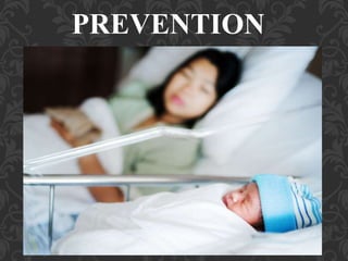 Umbilical Cord Prolapse, Presented By Mohammed Haroon Rashid