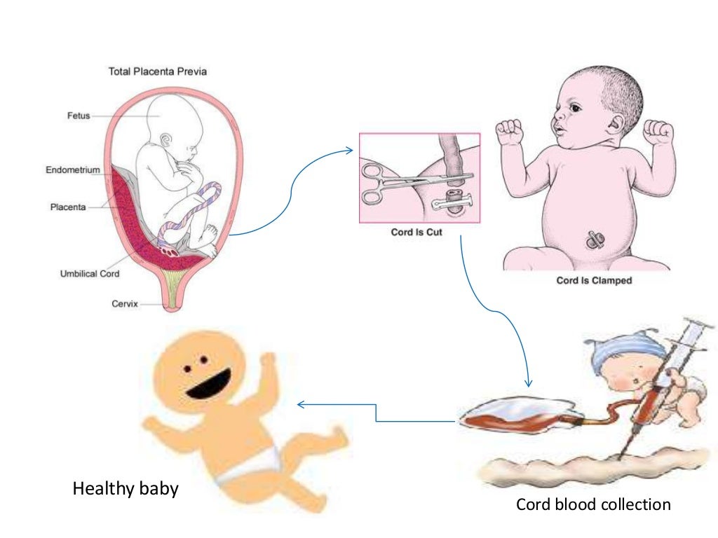 Umbilical cord stem cell