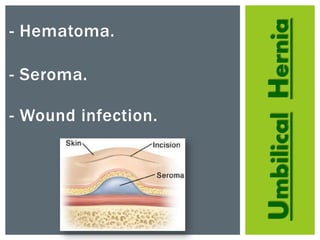 UmbilicalHernia
- Hematoma.
- Seroma.
- Wound infection.
 