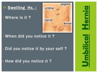 UmbilicalHernia
 Swelling Hx. :
- Where is it ?
- When did you notice it ?
- Did you notice it by your self ?
- How did you notice it ?
 