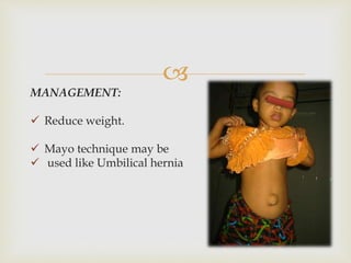
MANAGEMENT:
 Reduce weight.
 Mayo technique may be
 used like Umbilical hernia
 