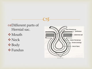 
Different parts of
Hernial sac.
Mouth
Neck
Body
Fundus
 