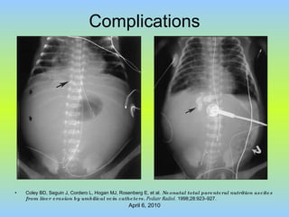 Complications Coley BD, Seguin J, Cordero L, Hogan MJ, Rosenberg E, et al.  Neonatal total parenteral nutrition ascites from liver erosion by umbilical vein catheters.   Pediatr Radiol.  1998;28:923–927. 