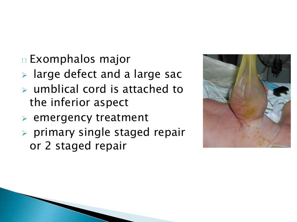 diseases of Umbilicus