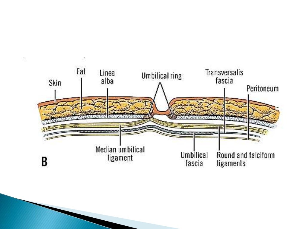 diseases of Umbilicus