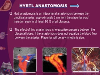  Hyrtl anastomosis is an interarterial anastomosis between the
umbilical arteries, approximately 3 cm from the placental cord
insertion seen in at least 95 % of all placenta.
 The effect of this anastomosis is to equalize pressure between the
placental lobes. If the anastomosis does not equalize the blood flow
between the arteries. Placental will be asymmetric is size.
3D
 