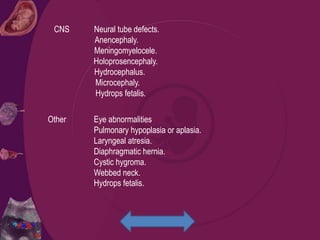 CNS Neural tube defects.
Anencephaly.
Meningomyelocele.
Holoprosencephaly.
Hydrocephalus.
Microcephaly.
Hydrops fetalis.
Other Eye abnormalities
Pulmonary hypoplasia or aplasia.
Laryngeal atresia.
Diaphragmatic hernia.
Cystic hygroma.
Webbed neck.
Hydrops fetalis.
 
