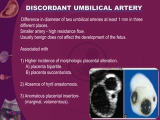 Difference in diameter of two umbilical arteries at least 1 mm in three
different places.
Smaller artery - high resistance flow.
Usually benign does not affect the development of the fetus.
Associated with
1) Higher incidence of morphologic placental alteration.
A) placenta bipartite.
B) placenta succenturiata.
2) Absence of hyrtl anastomosis.
3) Anomalous placental insertion-
(marginal, velamentous).
 