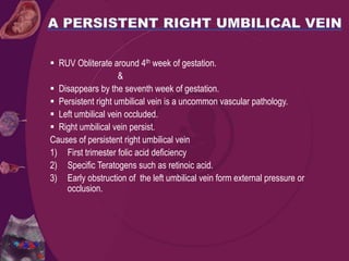  RUV Obliterate around 4th week of gestation.
&
 Disappears by the seventh week of gestation.
 Persistent right umbilical vein is a uncommon vascular pathology.
 Left umbilical vein occluded.
 Right umbilical vein persist.
Causes of persistent right umbilical vein
1) First trimester folic acid deficiency
2) Specific Teratogens such as retinoic acid.
3) Early obstruction of the left umbilical vein form external pressure or
occlusion.
 