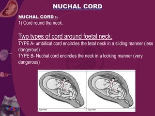 NUCHAL CORD :-
1) Cord round the neck.
Two types of cord around foetal neck.
TYPE A- umbilical cord encircles the fetal neck in a sliding manner (less
dangerous)
TYPE B- Nuchal cord encircles the neck in a locking manner (very
dangerous)
 