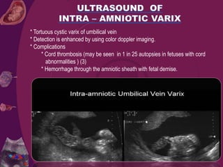 * Tortuous cystic varix of umbilical vein
* Detection is enhanced by using color doppler imaging.
* Complications
* Cord thrombosis (may be seen in 1 in 25 autopsies in fetuses with cord
abnormalities ) (3)
* Hemorrhage through the amniotic sheath with fetal demise.
 