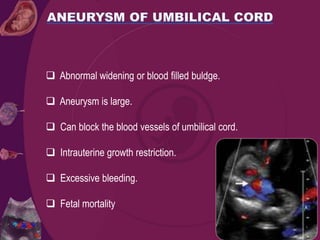  Abnormal widening or blood filled buldge.
 Aneurysm is large.
 Can block the blood vessels of umbilical cord.
 Intrauterine growth restriction.
 Excessive bleeding.
 Fetal mortality
 