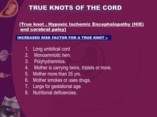 (True knot , Hypoxic Ischemic Encephalopathy (HIE)
and cerebral palsy)
1. Long umbilical cord
2. Monoamniotic twin.
3. Polyhydramnios.
4. Mother is carrying twins, triplets or more.
5. Mother more than 35 yrs.
6. Mother smokes or uses drugs.
7. Large for gestational age.
8. Nutritional deficiencies.
INCREASED RISK FACTOR FOR A TRUE KNOT :-
 