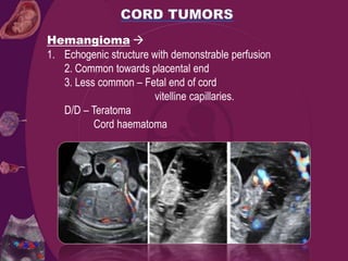 Hemangioma 
1. Echogenic structure with demonstrable perfusion
2. Common towards placental end
3. Less common – Fetal end of cord
vitelline capillaries.
D/D – Teratoma
Cord haematoma
 