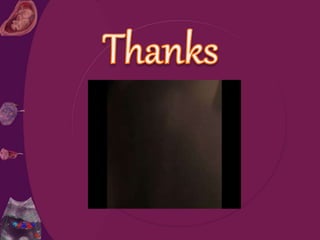 Umblical cord presentation