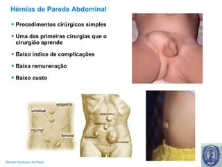 Hérnias de Parede Abdominal Procedimentos cirúrgicos simples Uma das primeiras cirurgias que o cirurgião aprende Baixo índice de complicações Baixa remuneração Baixo custo 