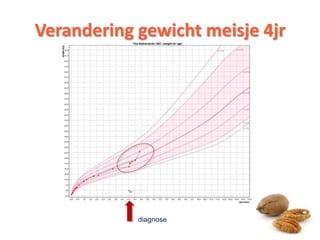 Verandering gewicht meisje 4jr
diagnose
7
 
