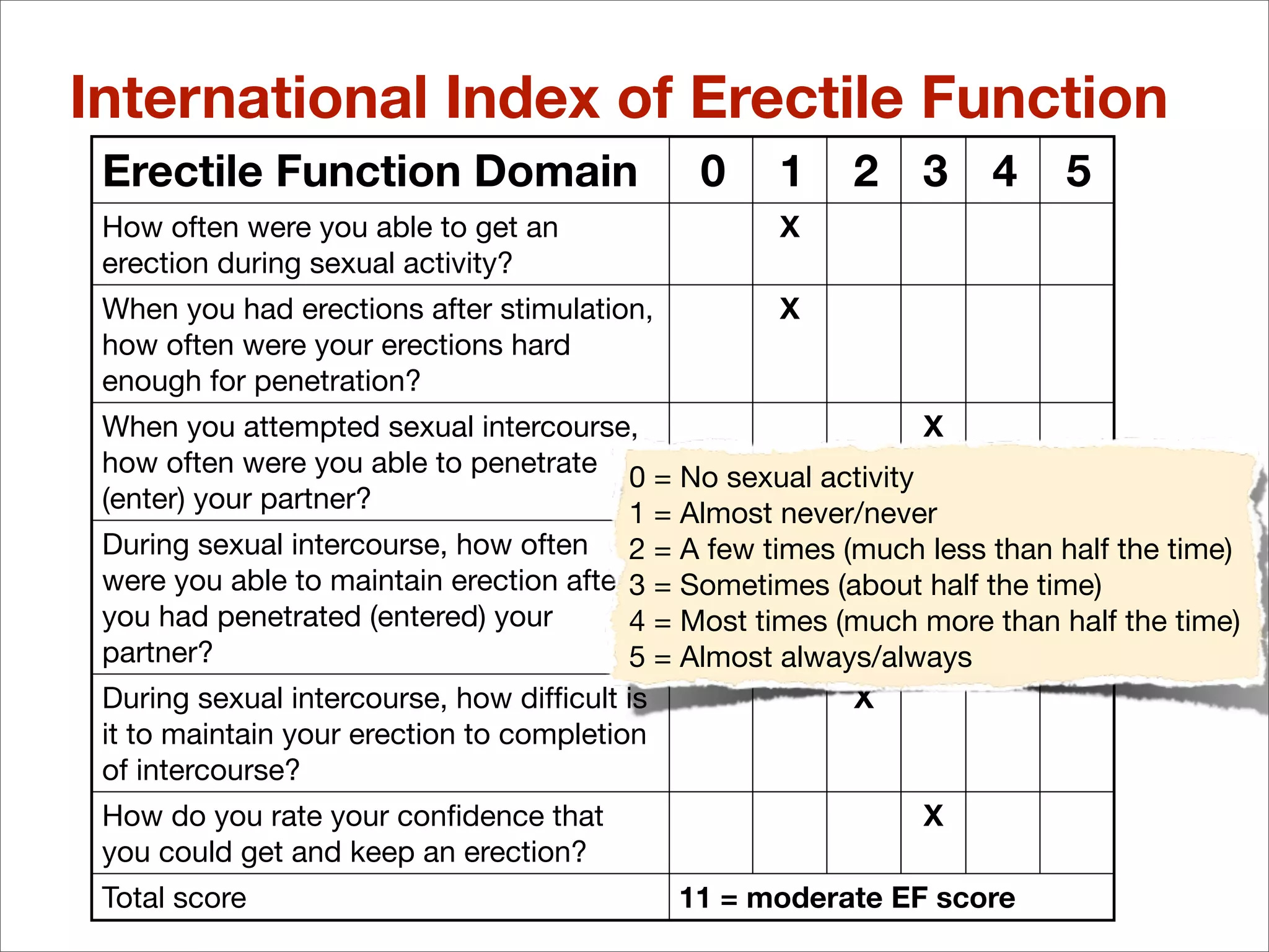International Index of Erectile Function
 Erectile Function Domain                     0     1    2     3    4    5
 How often were you able to get an                  X
 erection during sexual activity?
 When you had erections after stimulation,          X
 how often were your erections hard
 enough for penetration?
 When you attempted sexual intercourse,                      X
 how often were you able to penetrate 0 = No sexual activity
 (enter) your partner?                1 = Almost never/never
                                                     X
 During sexual intercourse, how often 2 = A few times (much less than half the time)
 were you able to maintain erection after 3 = Sometimes (about half the time)
 you had penetrated (entered) your        4 = Most times (much more than half the time)
 partner?                                 5 = Almost always/always
 During sexual intercourse, how difﬁcult is               X
 it to maintain your erection to completion
 of intercourse?
 How do you rate your conﬁdence that                           X
 you could get and keep an erection?
 Total score                                 11 = moderate EF score
 
