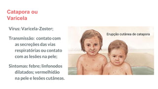 Catapora ou
Varicela
Vírus: Varicela-Zoster;
Transmissão: contato com
as secreções das vias
respiratórias ou contato
com as lesões na pele;
Sintomas: febre; linfonodos
dilatados; vermelhidão
na pele e lesões cutâneas.
 