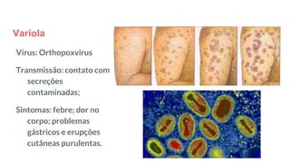 Varíola
Vírus: Orthopoxvirus
Transmissão: contato com
secreções
contaminadas;
Sintomas: febre; dor no
corpo; problemas
gástricos e erupções
cutâneas purulentas.
 