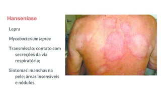 Hanseníase
Lepra
Mycobacterium leprae
Transmissão: contato com
secreções da via
respiratória;
Sintomas: manchas na
pele; áreas insensíveis
e nódulos.
 