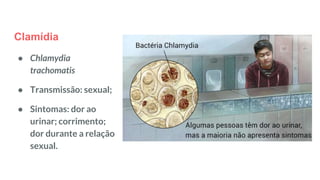 Clamídia
● Chlamydia
trachomatis
● Transmissão: sexual;
● Sintomas: dor ao
urinar; corrimento;
dor durante a relação
sexual.
 