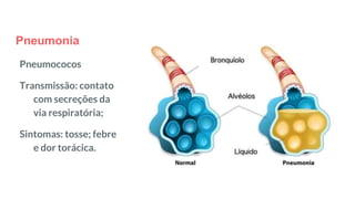 Pneumonia
Pneumococos
Transmissão: contato
com secreções da
via respiratória;
Sintomas: tosse; febre
e dor torácica.
 